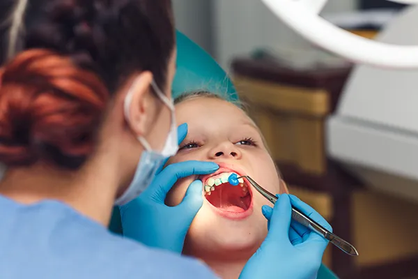 Young boy patiently keeping his mouth open while his female dental assistant applies fluoride.